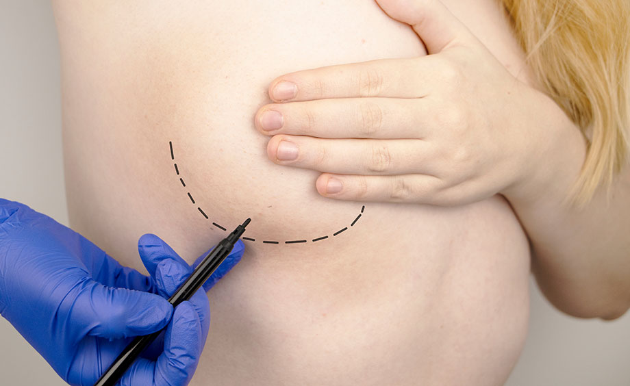 Lipofilling mammaire à Niort - Carré Esthétique Inkermann