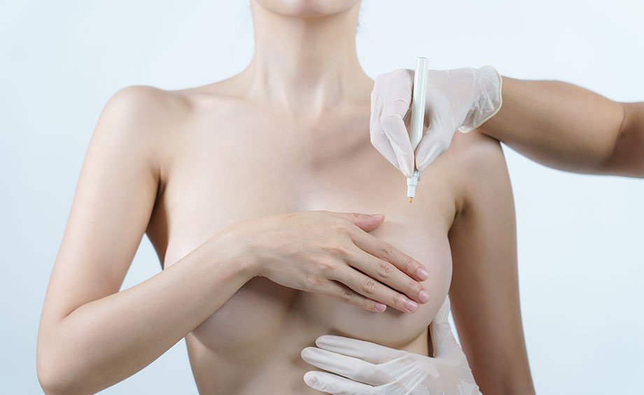 Réduction mammaire par ptohèses à Niort - Carré Esthétique Inkermann