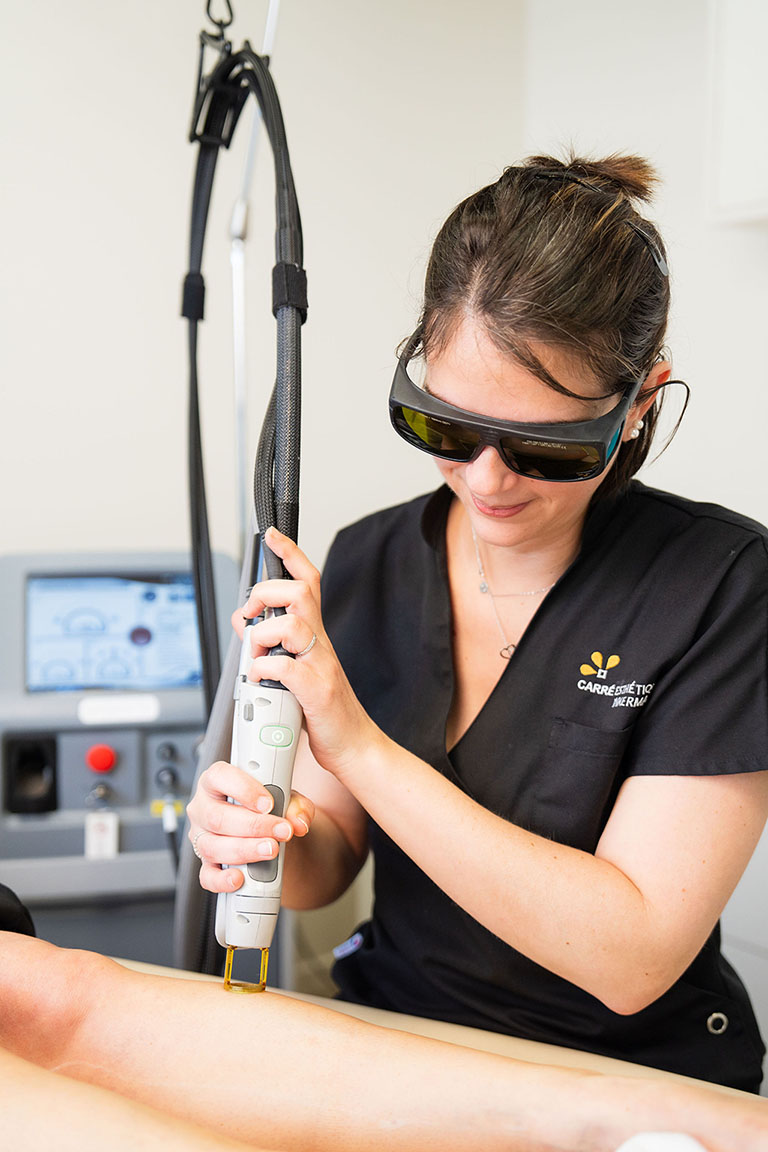 Epilation laser à Niort par laser Alexandrite / Nd:Yag
